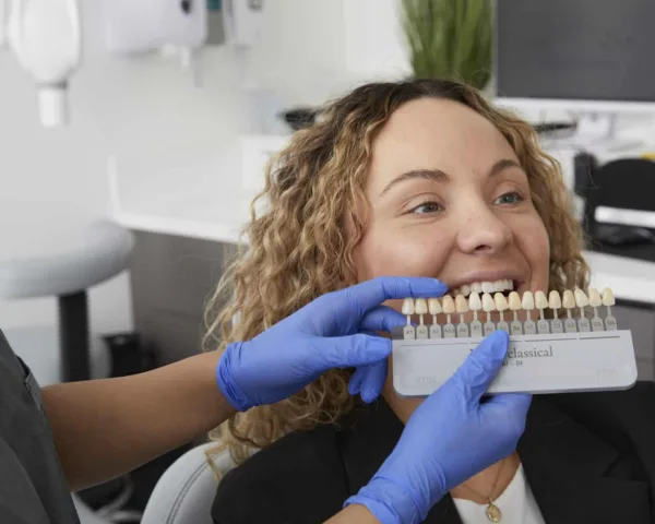 Permanent Veneers