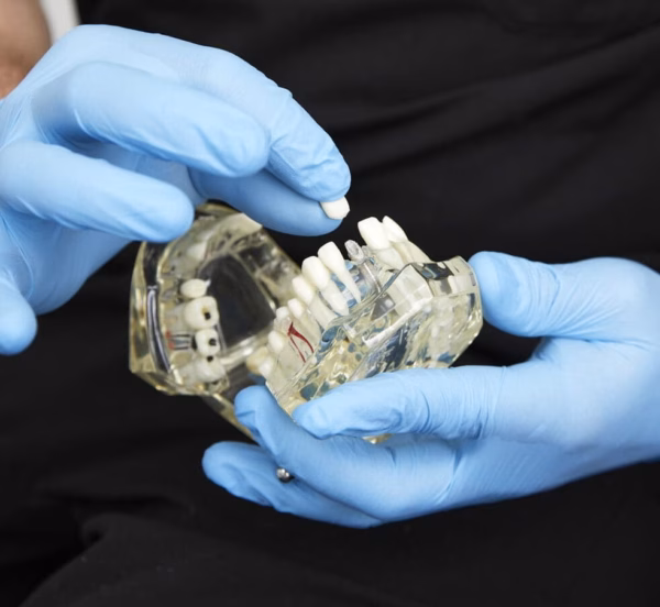 Solihull – All on Four Dental Implants