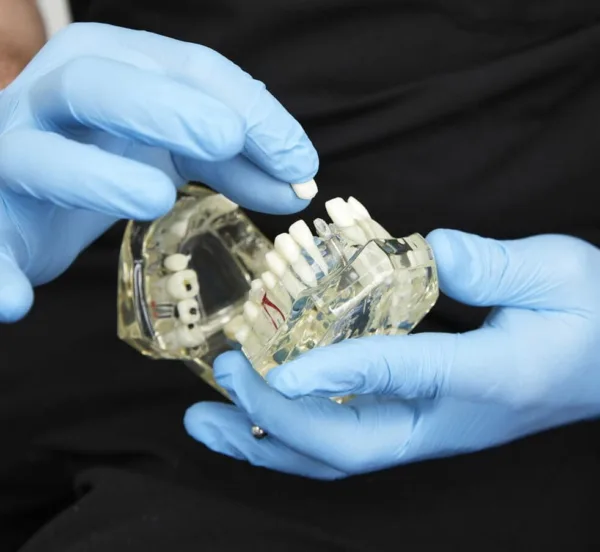 Solihull – All on Four Dental Implants