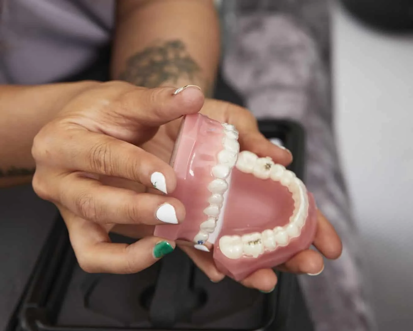 image of teeth mould for blog about the best ways to straighten teeth
