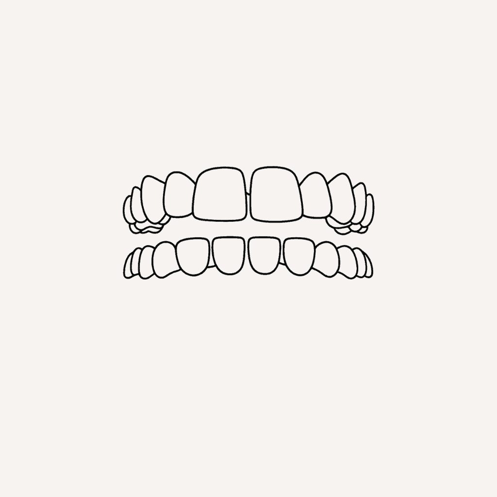 Gap-Teeth